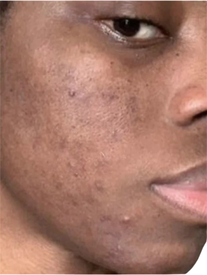 Avant