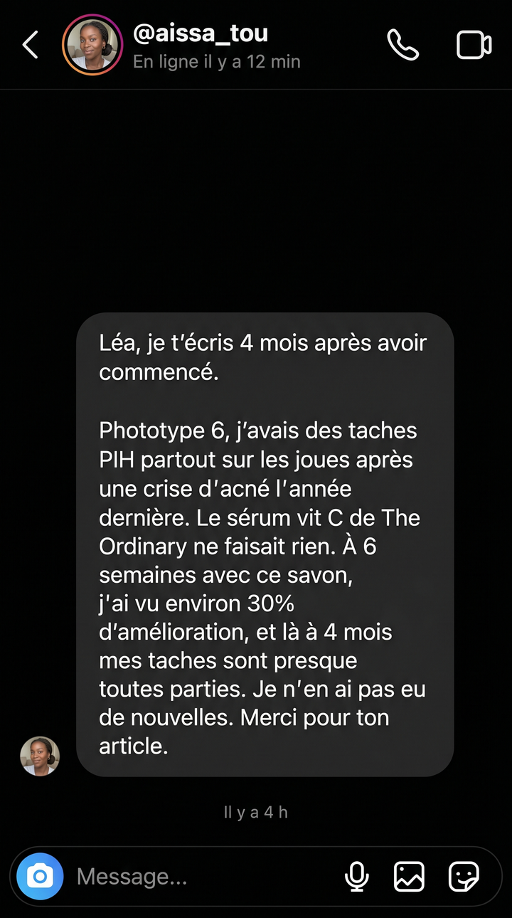 DM Instagram d'Aïssatou — témoignage à 4 mois