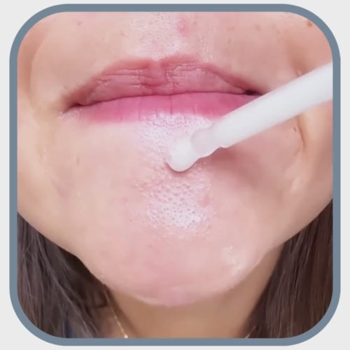 Vidéo